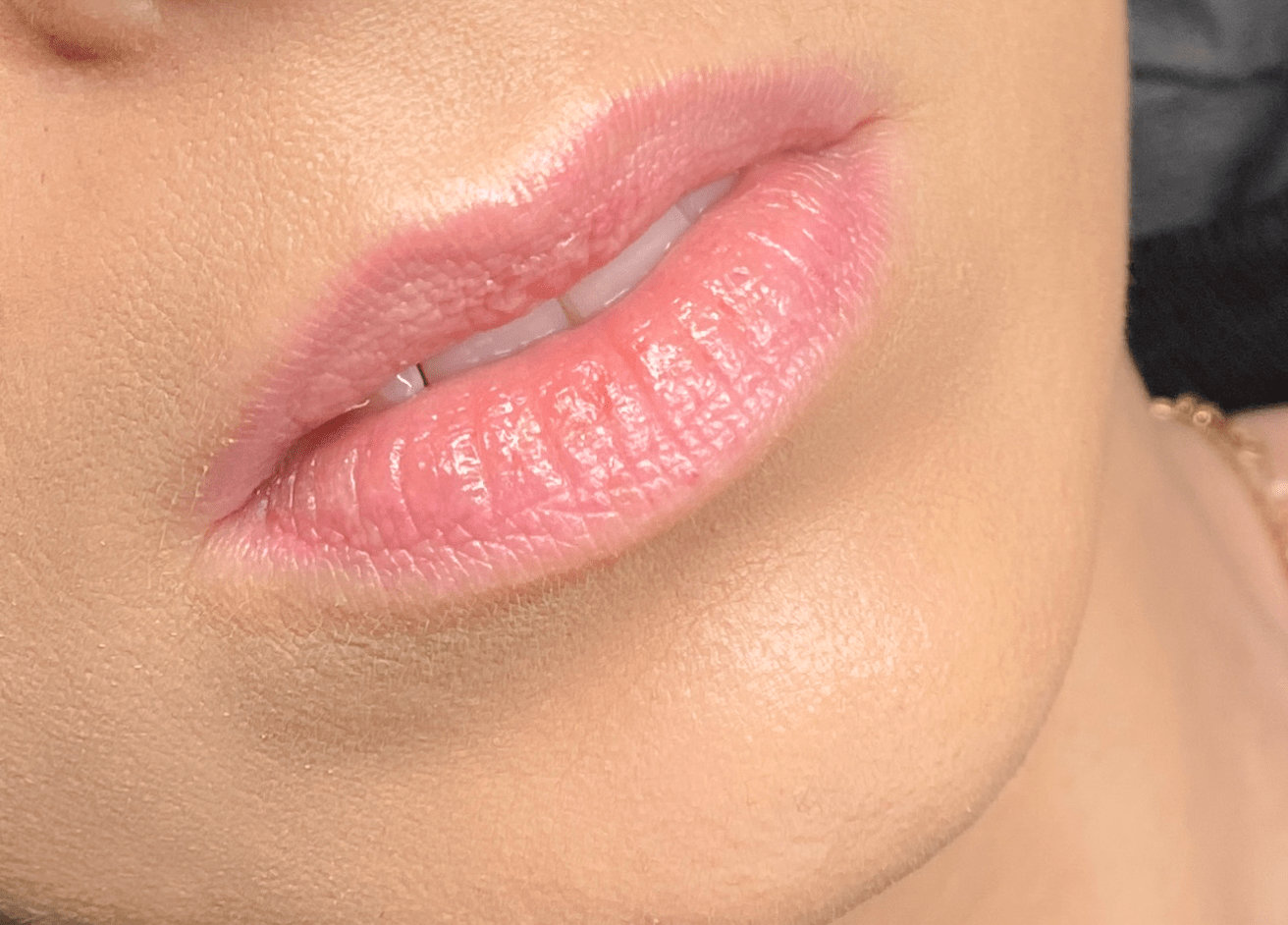 Exemples de réalisations de maquillage permanent lèvres, exemples de réalisation lip blush